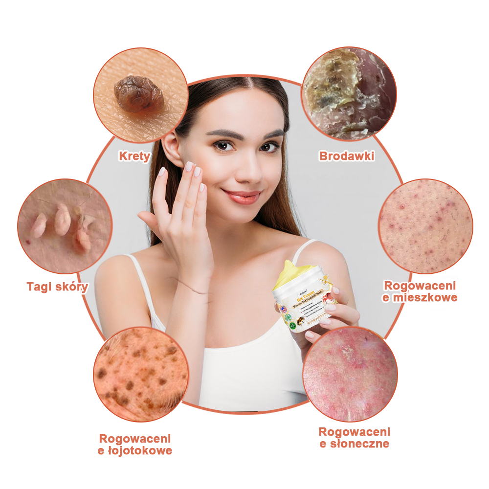 [🌟 Za pobraniem 🌟] 𝐀𝐰𝐳𝐥𝐨𝐯𝐞™ Krem leczący znamiona i brodawki z jadem pszczelim (👨‍⚕Zalecenia AAD )