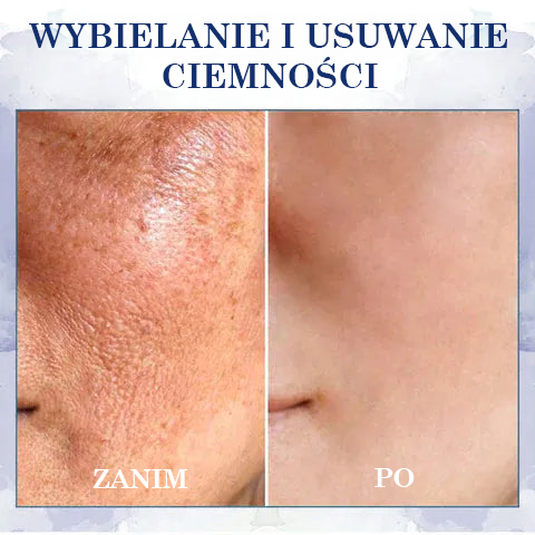 🔥 Ostatni dzień - 60% ZNIŻKI🔥Fubsta® Zaawansowany krem ujędrniający i redukujący zmarszczki: przywróć elastyczność skóry