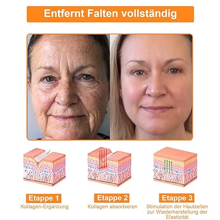 Bienengift Hautregenerationscreme, Professionelle Bienengift Creme, Ourlyard Bee Venom Hautregenerierende Creme, Bienengiftsalbe, Bienengiftcreme für alle Hauttypen
