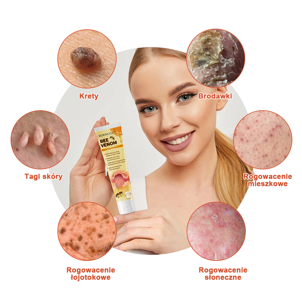 👨‍⚕️👨‍⚕️[✨Oficjalny sklep marki✨] Krem na pieprzyki i brodawki Zoencgz™ z jadem pszczelim (👨‍⚕AAD POLECA)