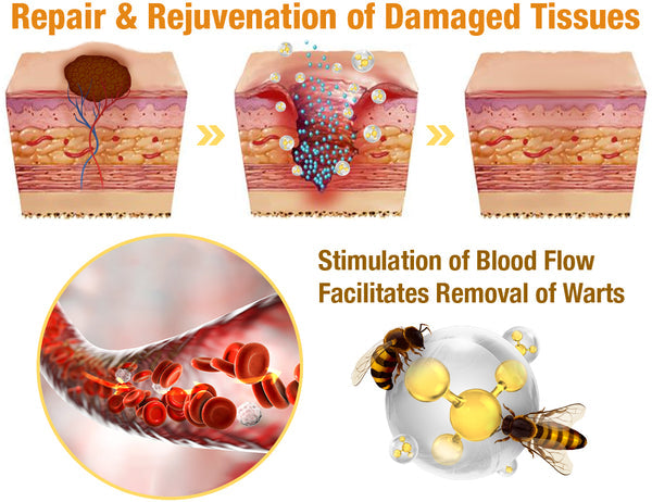 TLOPA™ Powerful All-Body Skin Treatment Cream (AAD Recommends It) ✨