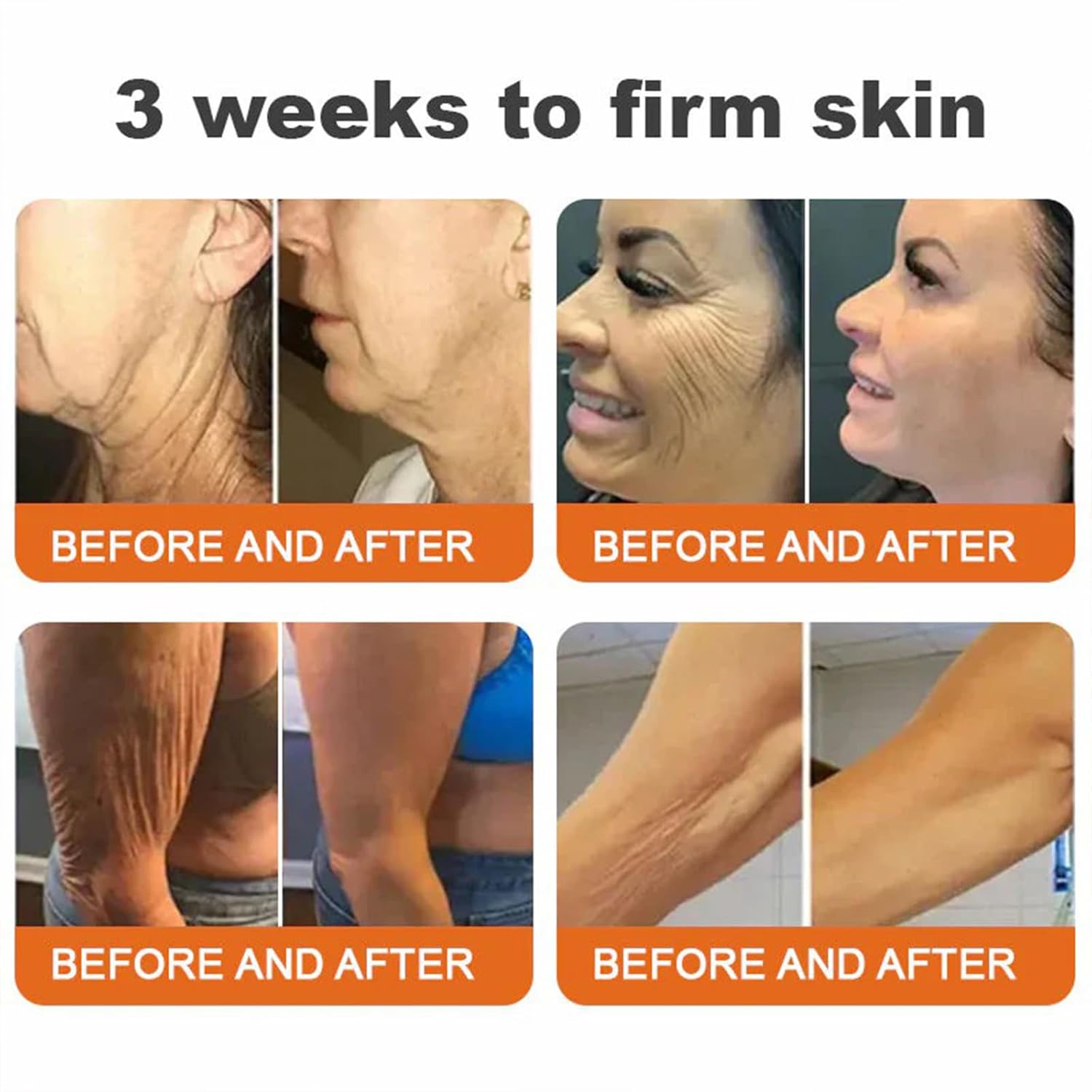 Botox Bee Venom Firming Stick, Advanced Firming Cream, Bee Venom Wrinkle Remover Cream, Bee Venom Firming Stick, Moisturizes and Nourishes Skin