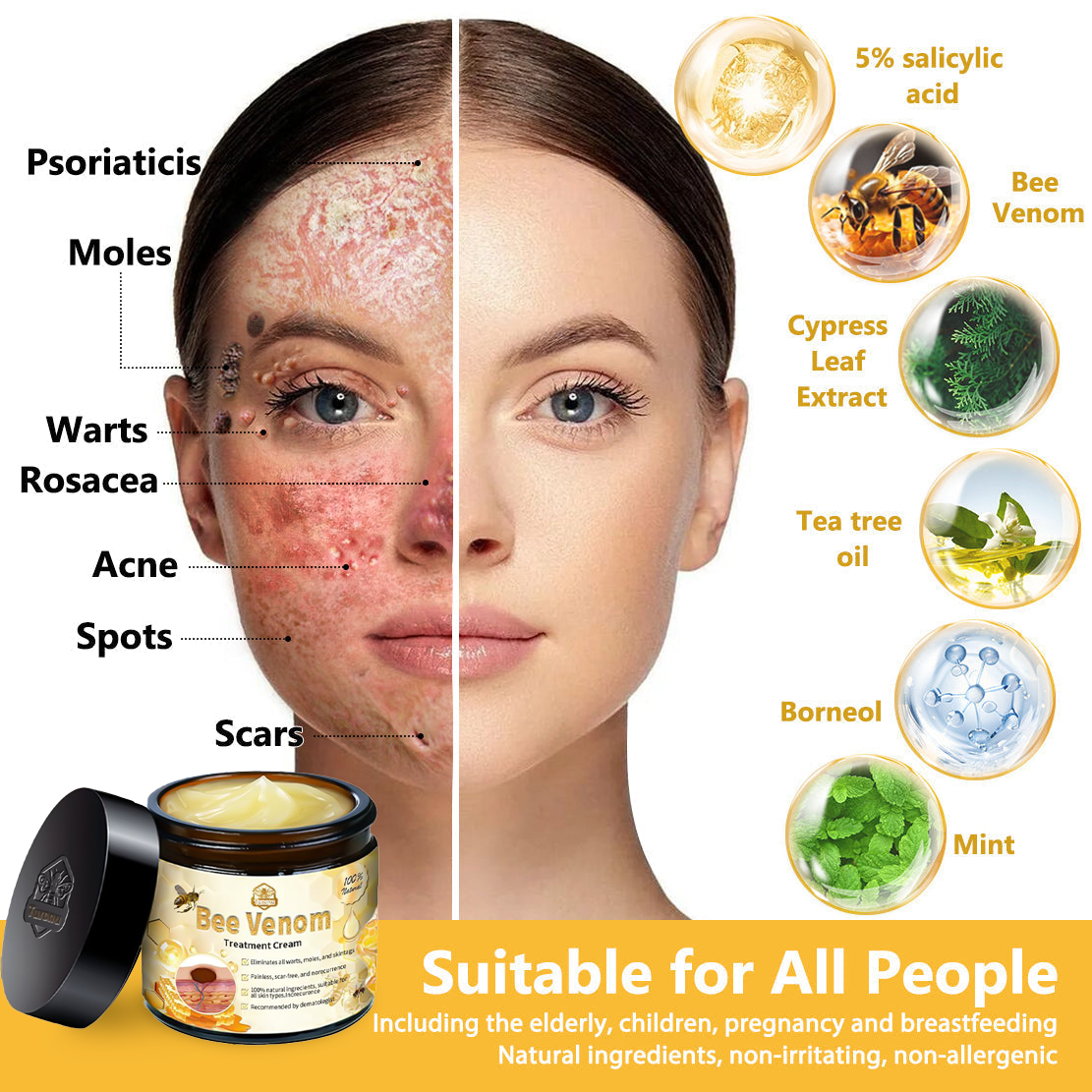 𝗧𝗟𝗢𝗣𝗔® Bee Venom Skin Treatment Cream – AAD Recommended👨‍⚕️(🔥LAST DAY 70% OFF)🔥