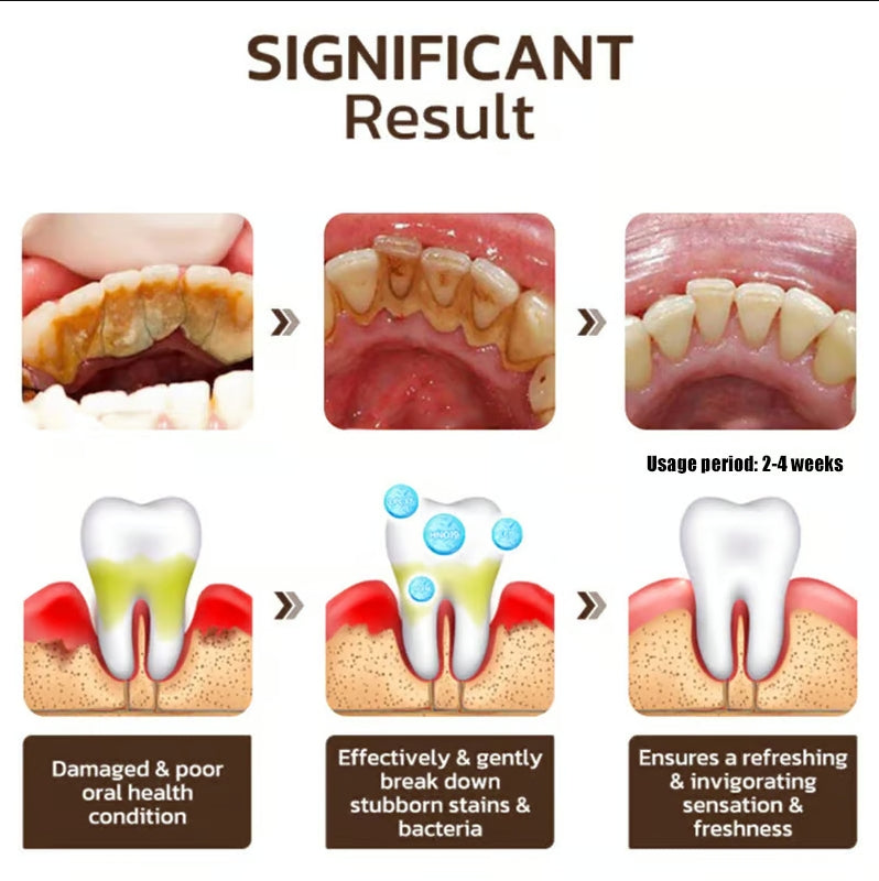 Cvreoz®Niacinamide Whitening Toothpaste-max