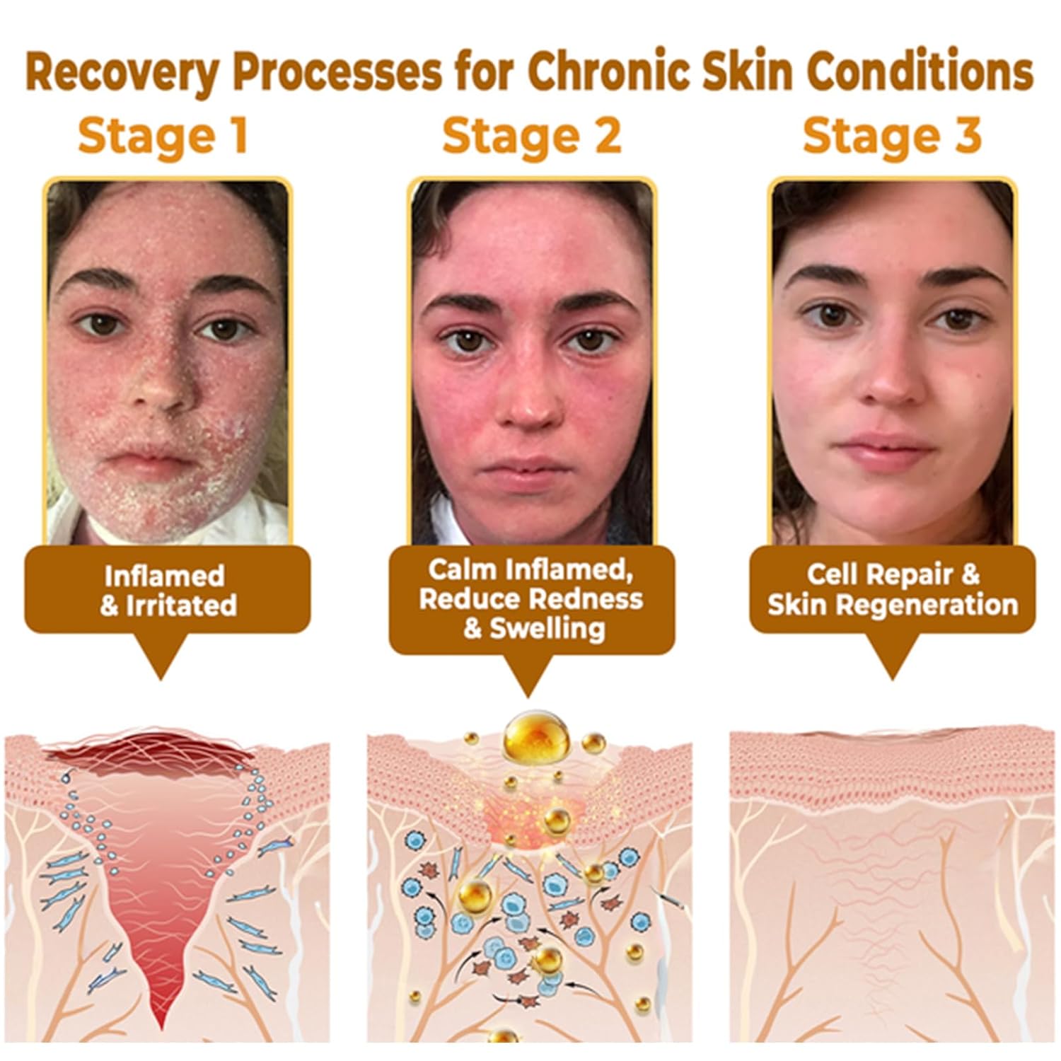 Awzlove Bee Venom Cream, Awzlove Bee Venom Rapid Skin Repair Cream, Bee Venom Skin Treatment cream, Effective In Reducing skin Blemishes, Gentle and Non-irritating for All Types