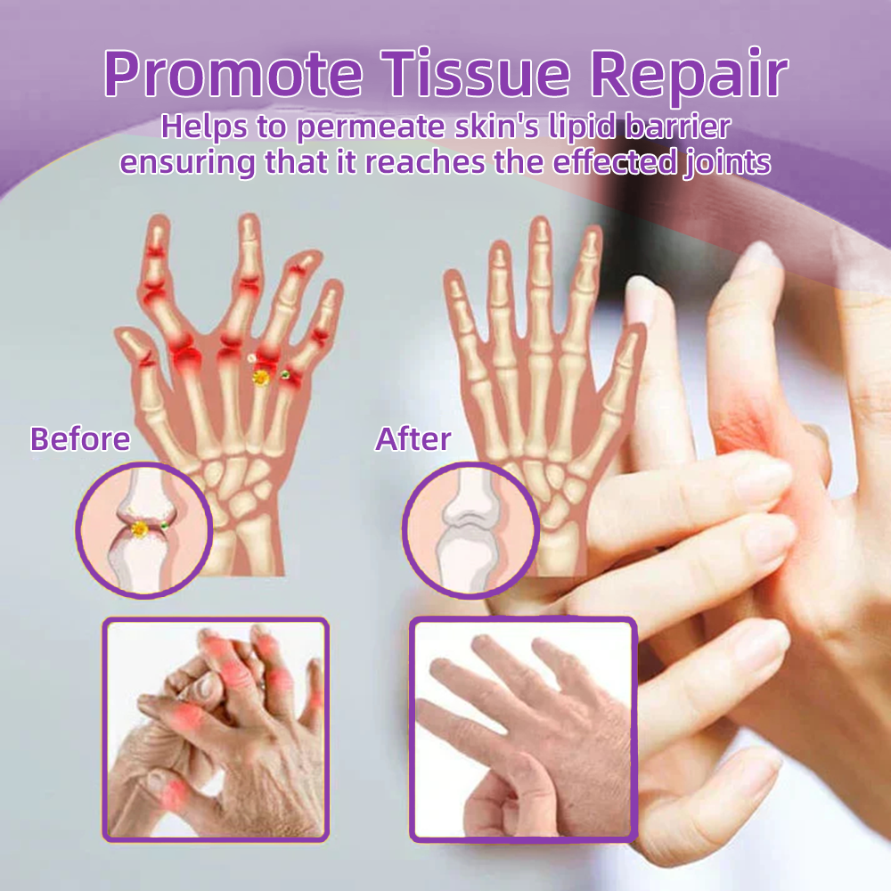 𝐎𝐟𝐟𝐢𝐜𝐢𝐚𝐥 𝐒𝐭𝐨𝐫𝐞: 𝐓𝐋𝐎𝐏𝐀® 𝑺𝒉𝒂𝒓𝒌 𝑪𝒂𝒓𝒕𝒊𝒍𝒂𝒈𝒆 𝑷𝒂𝒊𝒏-𝑺𝒐𝒐𝒕𝒉𝒊𝒏𝒈 𝑩𝒐𝒏𝒆 𝑹𝒆𝒄𝒐𝒗𝒆𝒓𝒚 𝑮𝒆𝒍 👨‍⚕️𝑨𝒎𝒆𝒓𝒊𝒄𝒂𝒏 𝑨𝒄𝒂𝒅𝒆𝒎𝒚 𝒐𝒇 𝑶𝒓𝒕𝒉𝒐𝒑𝒂𝒆𝒅𝒊𝒄 𝑺𝒖𝒓𝒈𝒆𝒐𝒏𝒔 (𝑨𝑨𝑶𝑺) 𝒓𝒆𝒄𝒐𝒎𝒎𝒆𝒏𝒅 (5-𝗆𝗂𝗇𝗎𝗍𝖾 𝗉𝖺𝗂𝗇 𝗋𝖾𝗅𝗂𝖾𝖿, 𝟩 𝖽𝖺𝗒𝗌 𝗍𝗈 𝗋𝖾𝗌𝗍𝗈𝗋𝖾 𝗃𝗈𝗂𝗇𝗍 𝗆𝗈𝖻𝗂𝗅𝗂𝗍𝗒, 𝟦 𝗐𝖾𝖾𝗄𝗌 𝖿𝗈𝗋 𝖼𝗈𝗆𝗉𝗅𝖾𝗍𝖾 𝗁𝖾𝖺𝗅𝗂𝗇𝗀)