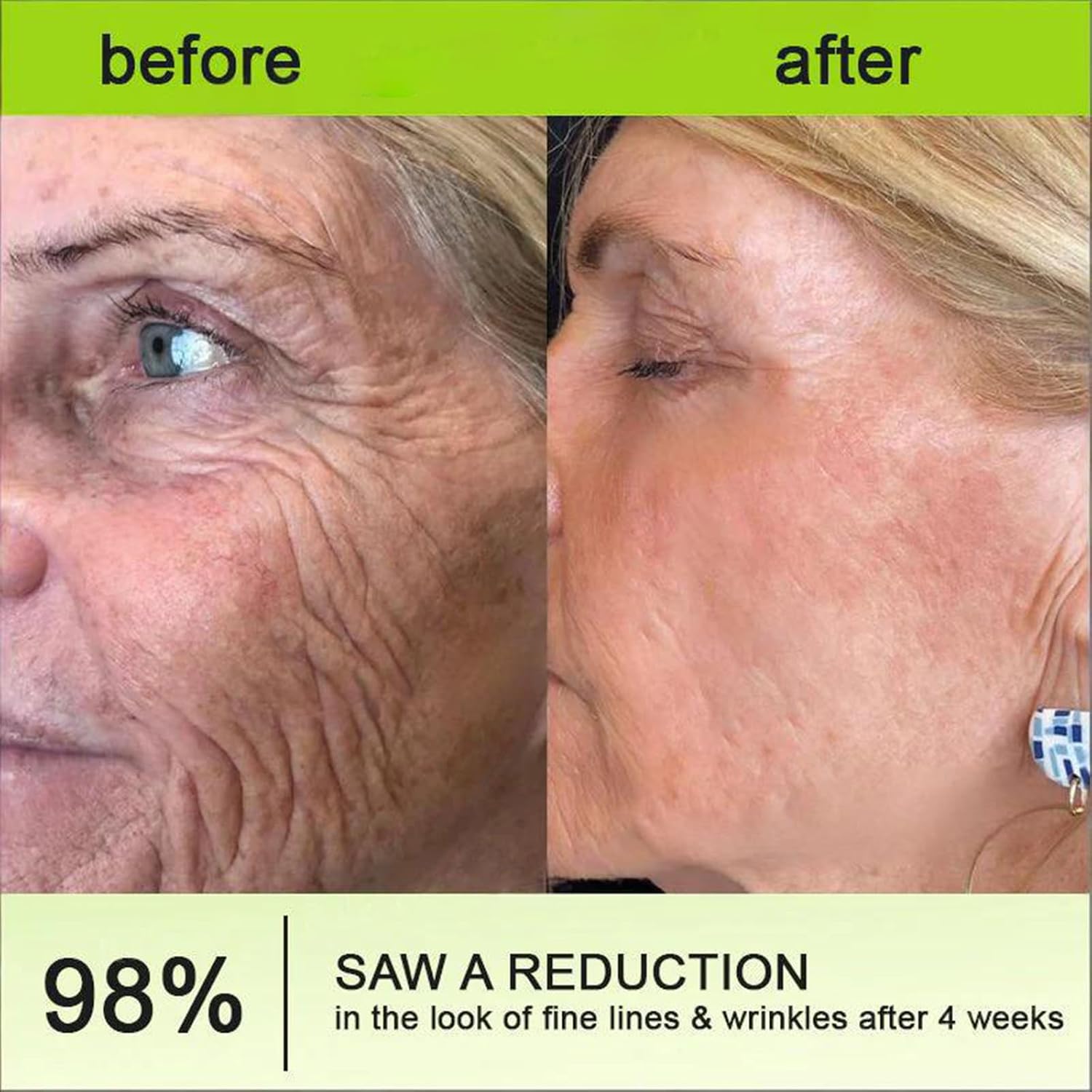 Celestvéra Botoxmix Peptide Anti-Wrinkle Cream Lift Tightening Booster, 2026 New Celestvera Lift Tightening Booster, Pore Minimizer, Natural Retinal Shot Anti-Wrinkle Serum for All Skin Types