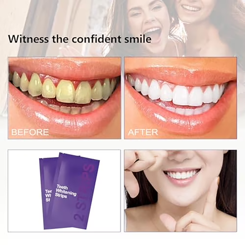 Purple Teeth Whitening Strips—gentle, daily-use whitening strips that reduce surface stains and impart a natural shine; portable and enamel-safe, suitable for use at home or on the go.