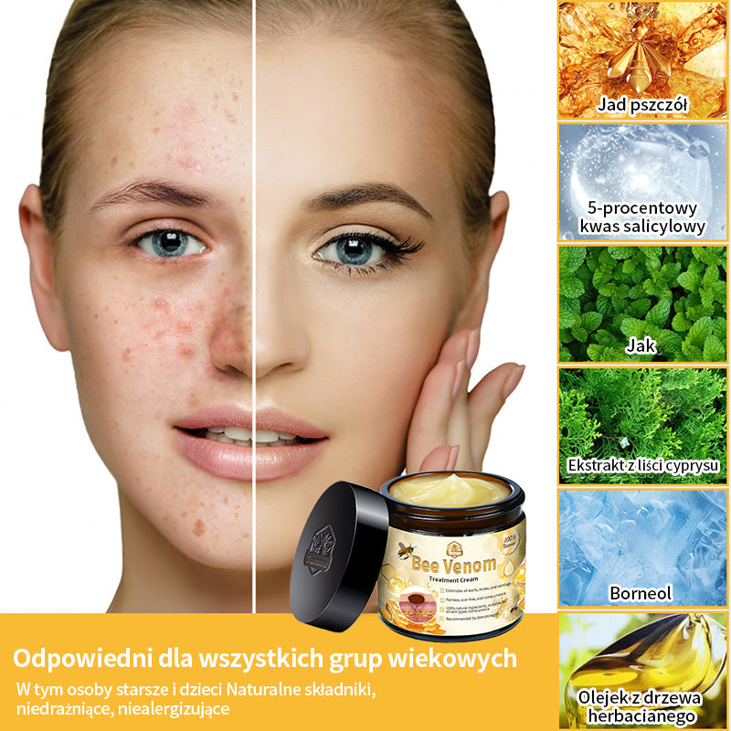 🐝🏪[Oficjalny sklep flagowy] 𝑇𝑢𝑟𝑜𝑛𝑢™ 𝖪𝗋𝖾𝗆 𝖽𝗈 𝗉𝗂𝖾𝗅ę𝗀𝗇𝖺𝖼𝗃𝗂 𝗌𝗄ó𝗋𝗒 𝗓 𝗃𝖺𝖽𝖾𝗆 𝗉𝗌𝗓𝖼𝗓𝖾𝗅𝗂𝗆 (𝗓𝖺𝗅𝖾𝖼𝖺𝗇𝗒 𝗉𝗋𝗓𝖾𝗓 𝖠𝖠𝖣)