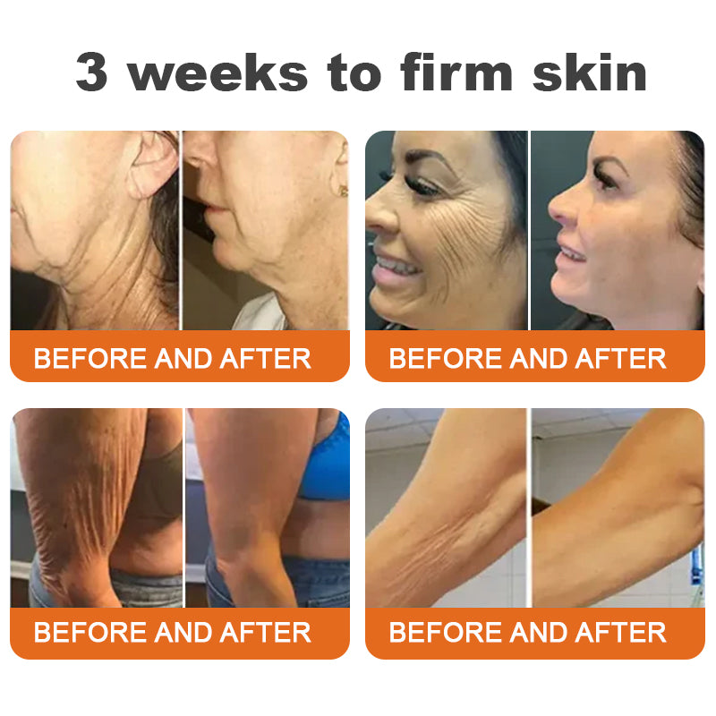 Made and Shipped from USA✨TLOPA® Botox Bee Venom Firming Serum Stick✨(🔥LAST DAY 70% OFF)🔥