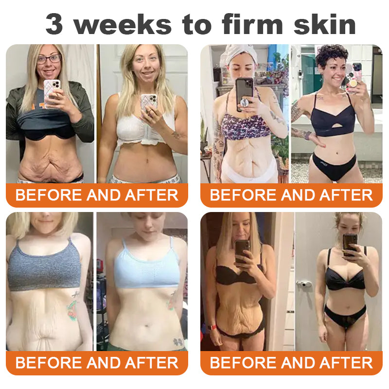 Made and Shipped from USA✨TLOPA® Botox Bee Venom Firming Serum Stick(🔥LAST DAY 70% OFF)💄💄