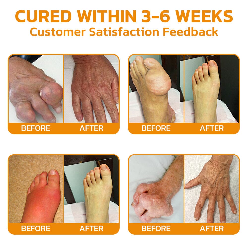 Furzero™ Bee Venom Pain Suppression Joint Healing Cream (👩🏼‍⚕️AAOS Recommended)