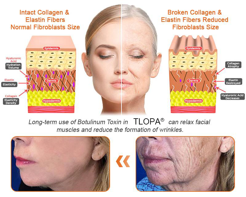 Made and Shipped from USA ✨Top Dermatologists' Recommendation✨ TLOPA® Botox Bee Venom Anti-Aging Firming Gel🔥