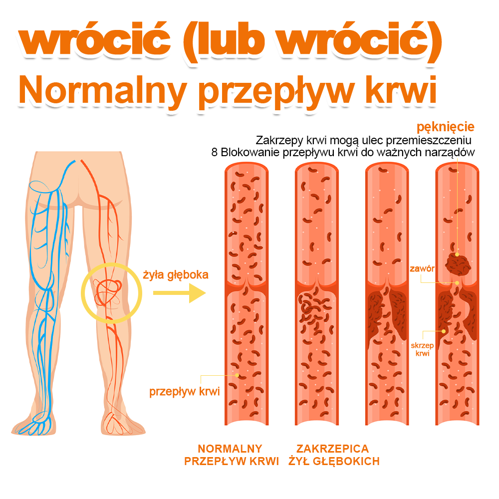 🏆🌈[✨Oficjalny sklep flagowy✨]Zoencgz™ Krem na zapalenie stawów i żylaki z jadem pszczelim