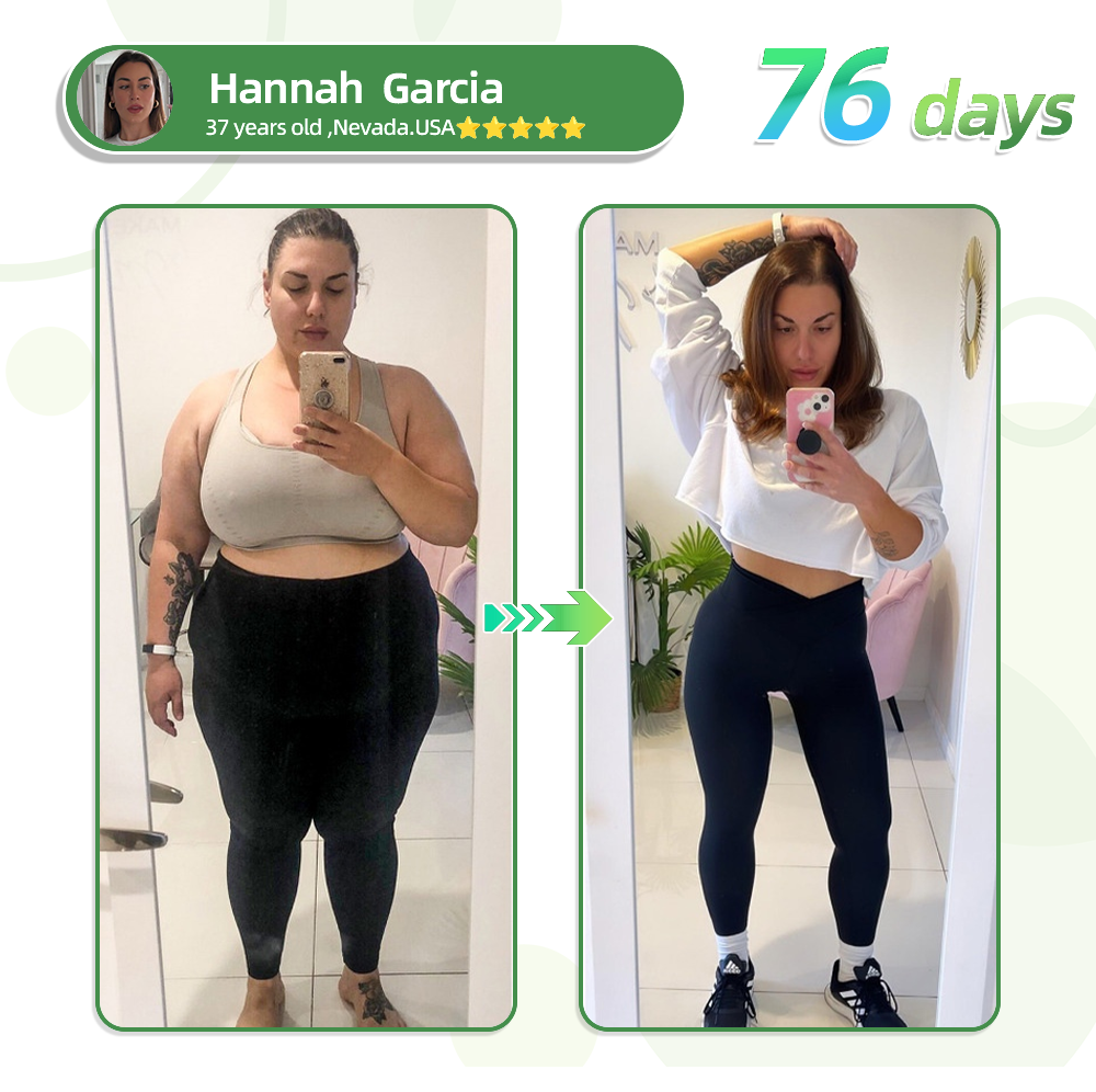 [See results in 7 days]🌻𝗧𝗟𝗢𝗣𝗔® SMGT-GLP-1 Nano Microneedle Patch (Painless, long-lasting, addressing diabetes, obesity, and cardiovascular diseases)🌻