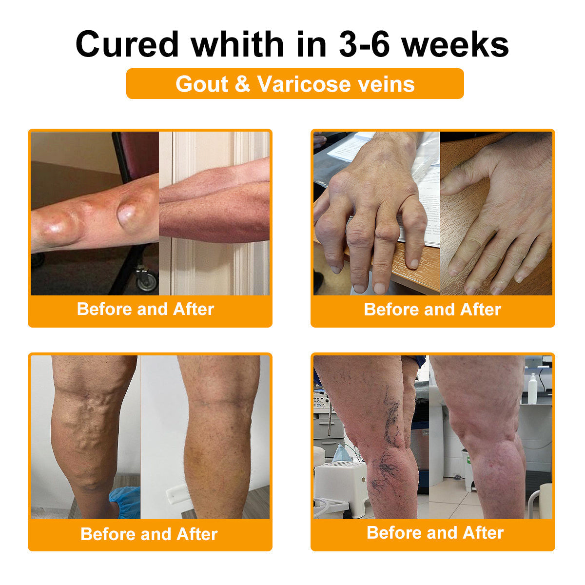 ADNOON™ Botulinum Toxin & Bee Venom Pain-Relief Bone Healing Cream