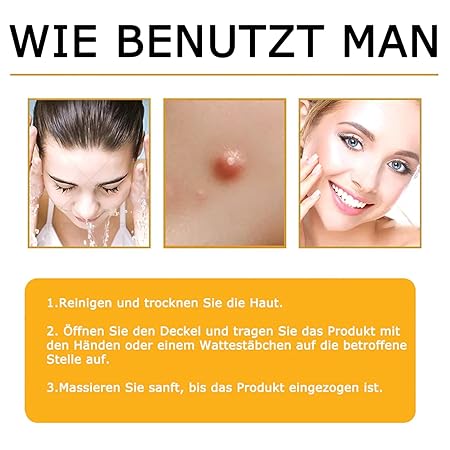 Bienengift Pro Umfassende Creme, Professionelle bienengift Therapie Creme, Ourlyard Bee Venom Hautregenerierende Creme, bienengift cremes, Bienengiftsalbe, für alle Hauttypen