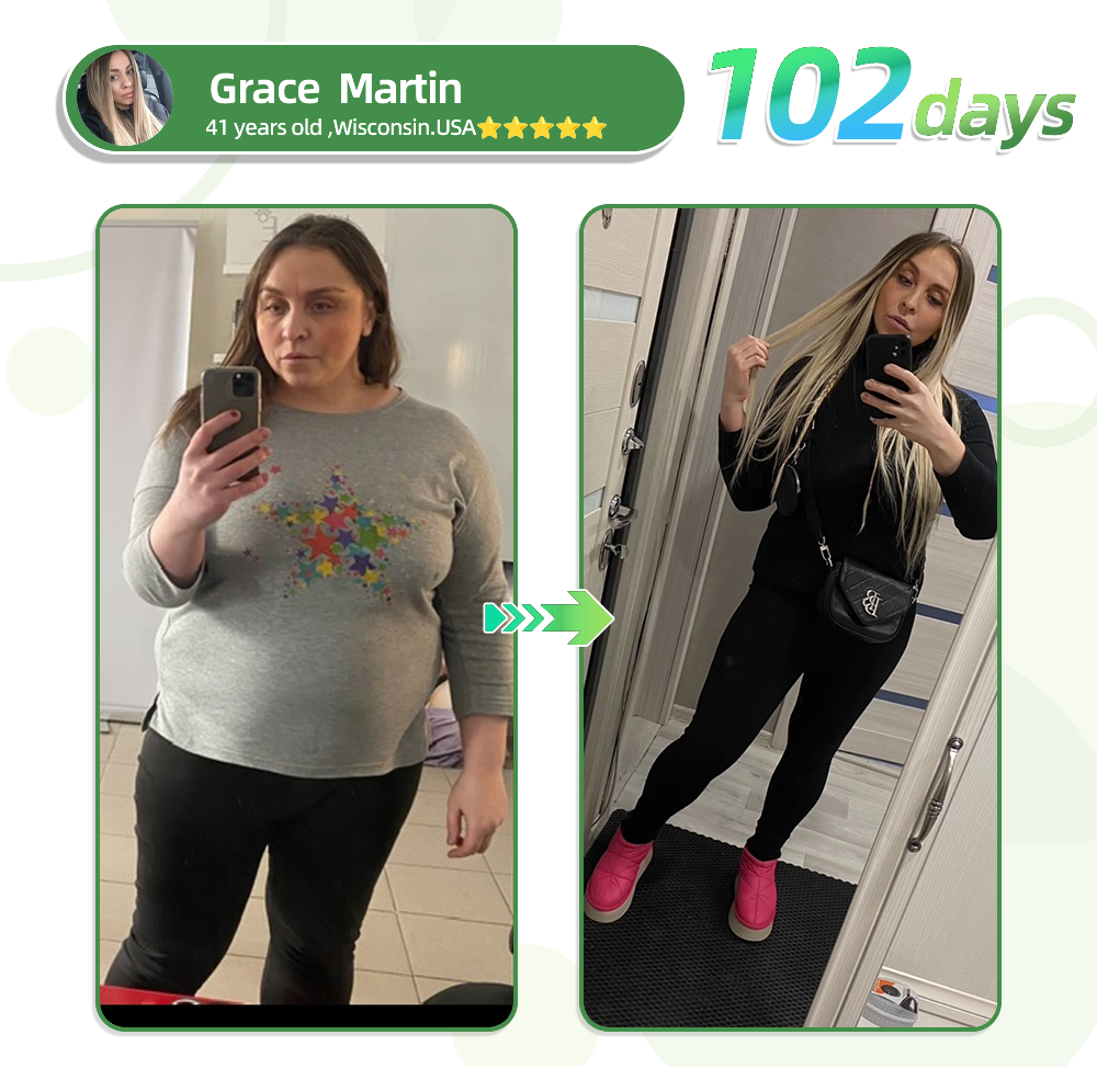 [See results in 7 days]💐𝗧𝗟𝗢𝗣𝗔® SMGT-GLP-1 Nano Microneedle Patch (Painless, long-lasting, addressing diabetes, obesity, and cardiovascular diseases)💐