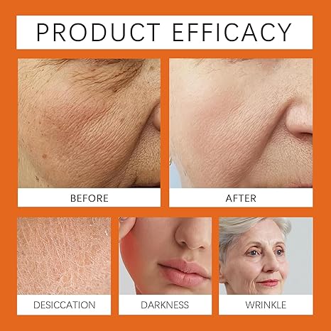 Bee venom skin repair cream, advanced firming and anti-wrinkle, professional bee venom skin care cream, natural bee venom comprehensive cream, suitable for all skin types