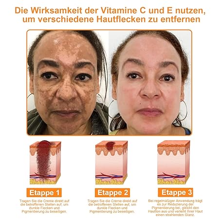 Bienengift Hautregenerationscreme, Professionelle Bienengift Creme, Ourlyard Bee Venom Hautregenerierende Creme, Bienengiftsalbe, Bienengiftcreme für alle Hauttypen