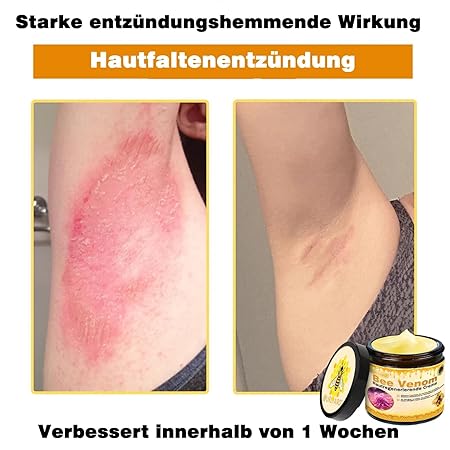 Bienengift Pro Umfassende Creme, Professionelle bienengift Therapie Creme, Ourlyard Bee Venom Hautregenerierende Creme, bienengift cremes, Bienengiftsalbe, für alle Hauttypen