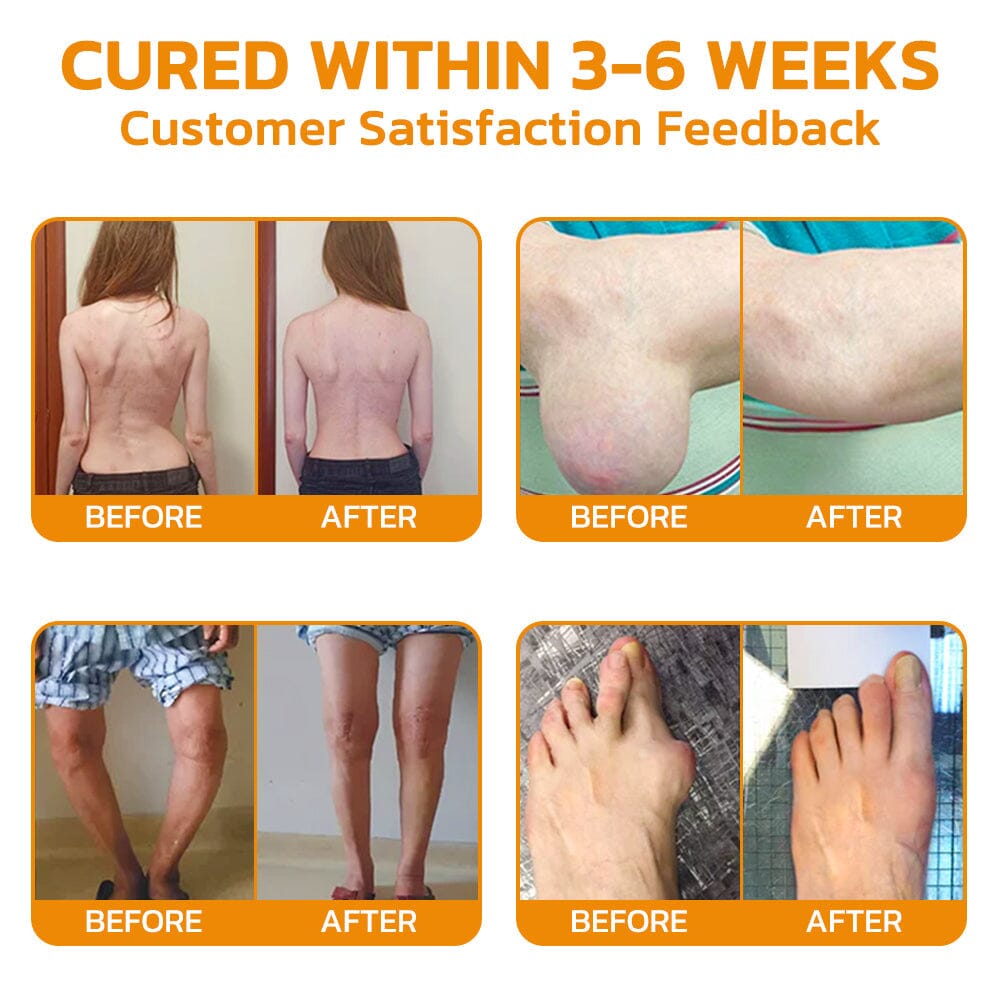 Furzero™ Bee Venom Pain Suppression Joint Healing Cream (👩🏼‍⚕️AAOS Recommended)