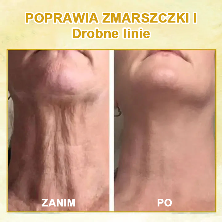 ✨ Zniżka ostatniego dnia: 60% ZNIŻKI🌿𝐅𝐮𝐛𝐬𝐭𝐚® olejek odmładzający ujędrniający skórę💧