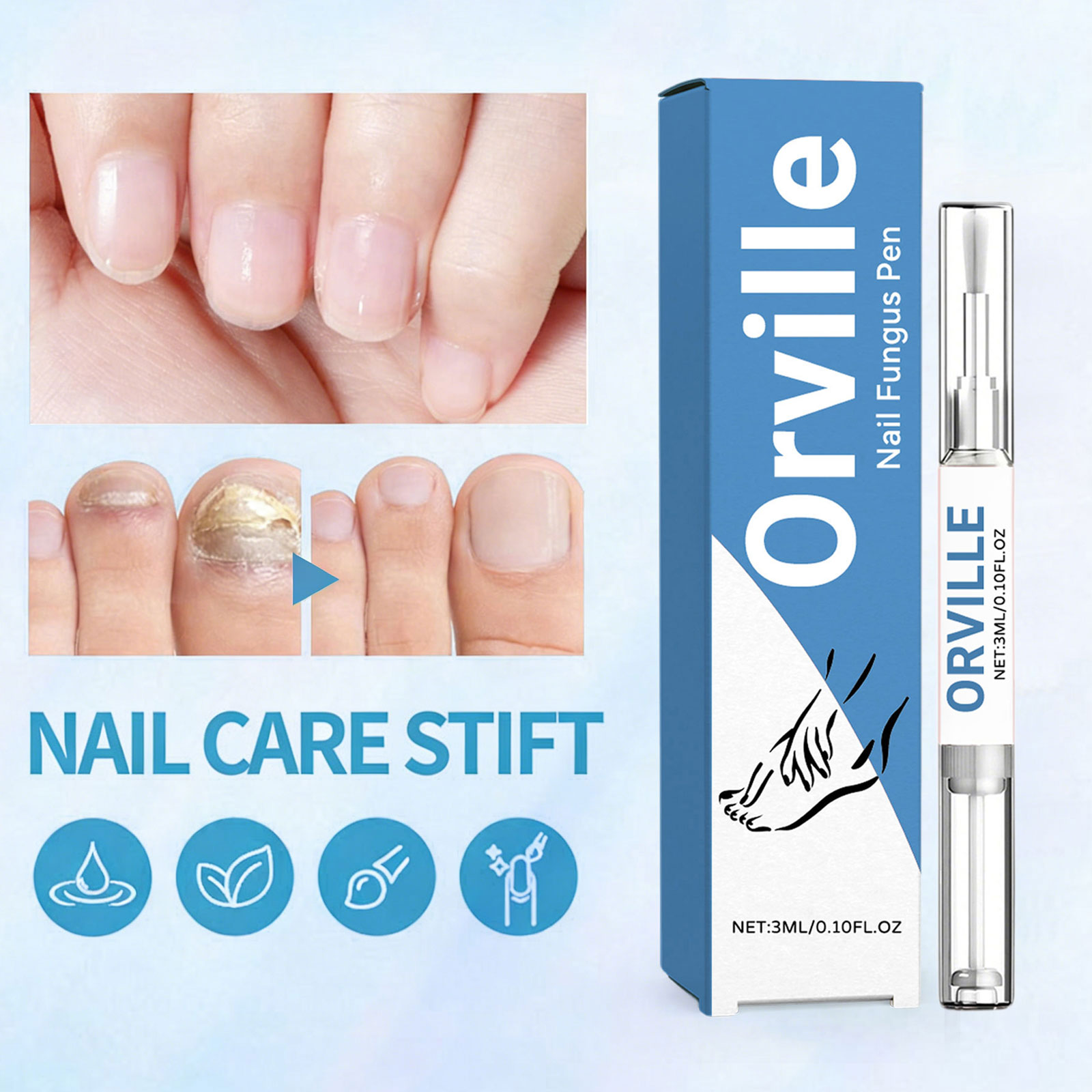 Orville Nagelpilz Stift Original, Natürliches Inhaltsstoffserum für Stärkungsnägel, 2026 Neu Nail Care Pen Nagelpilz für Jeden Geeignet