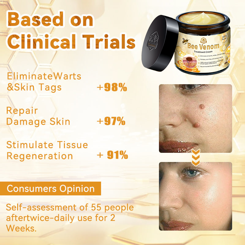 𝗧𝗟𝗢𝗣𝗔® Bee Venom Skin Treatment Cream – AAD Recommended👨‍⚕️(🔥LAST DAY 70% OFF)🔥