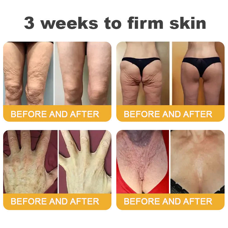 Made and Shipped from USA ✨Top Dermatologists' Recommendation✨ TLOPA® Botox Bee Venom Anti-Aging Firming Gel🔥