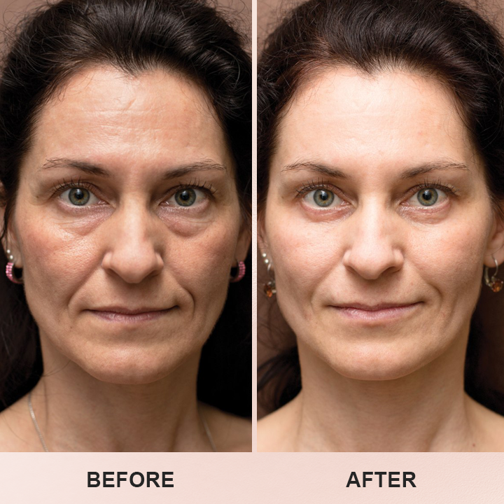 LIMETOW™ Anti-Wrinkle Stick