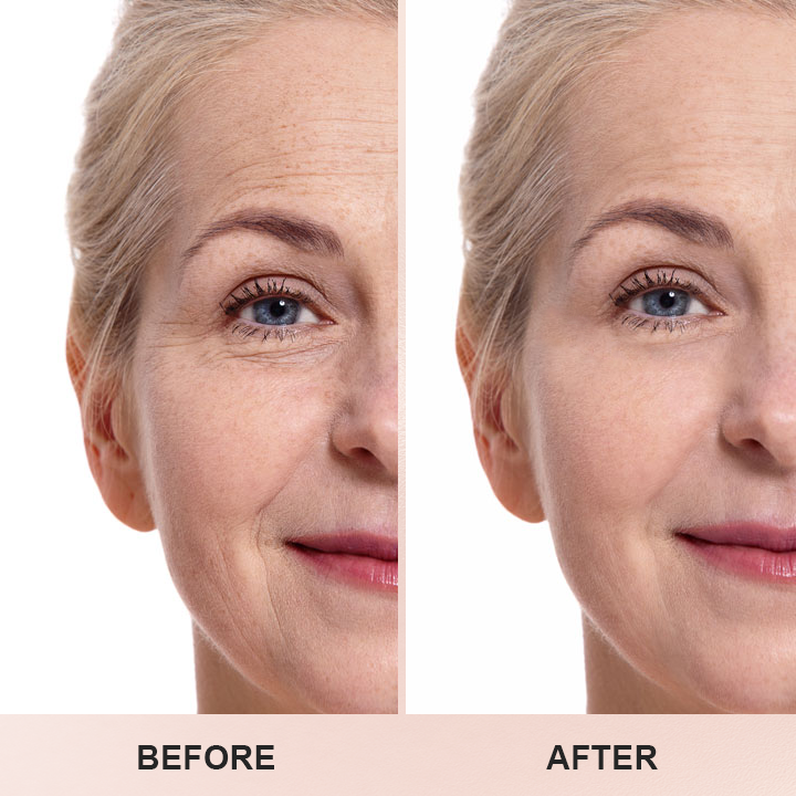 LIMETOW™ Anti-Wrinkle Stick