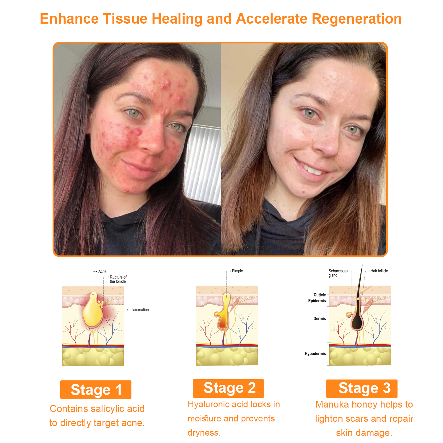 TLOPA™ Powerful All-Body Skin Treatment Cream (AAD Recommends It) 💐🌹