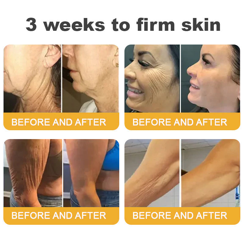 Made and Shipped from USA ✨Top Dermatologists' Recommendation✨ TLOPA® Botox Bee Venom Anti-Aging Firming Gel🔥