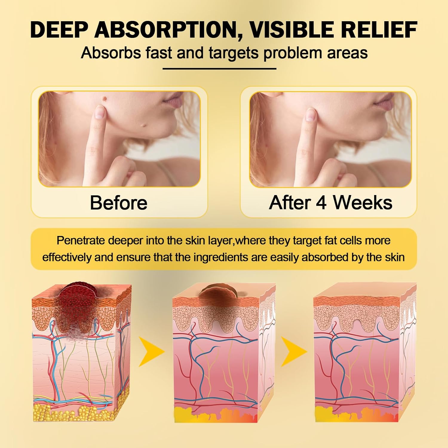 Bee Venom Cream Canada, Bee Venom Skin Treatment Cream, Botanic Hydration Serum for All Skin Types, 60 Ml (1pcs)