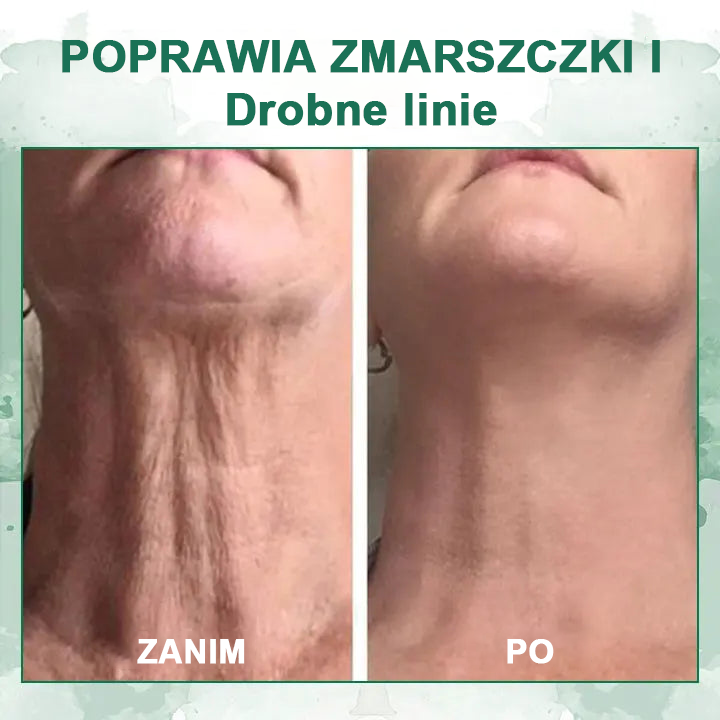 🌿💝Ostatni dzień promocji 60% Zniżki - Fubsta™ Serum odmładzające ujędrniające skórę🔥