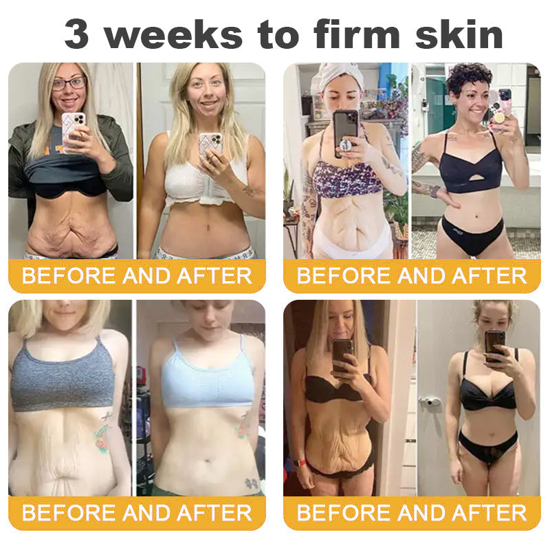 Made and Shipped from USA ✨Top Dermatologists' Recommendation✨ TLOPA® Botox Bee Venom Anti-Aging Firming Gel🔥