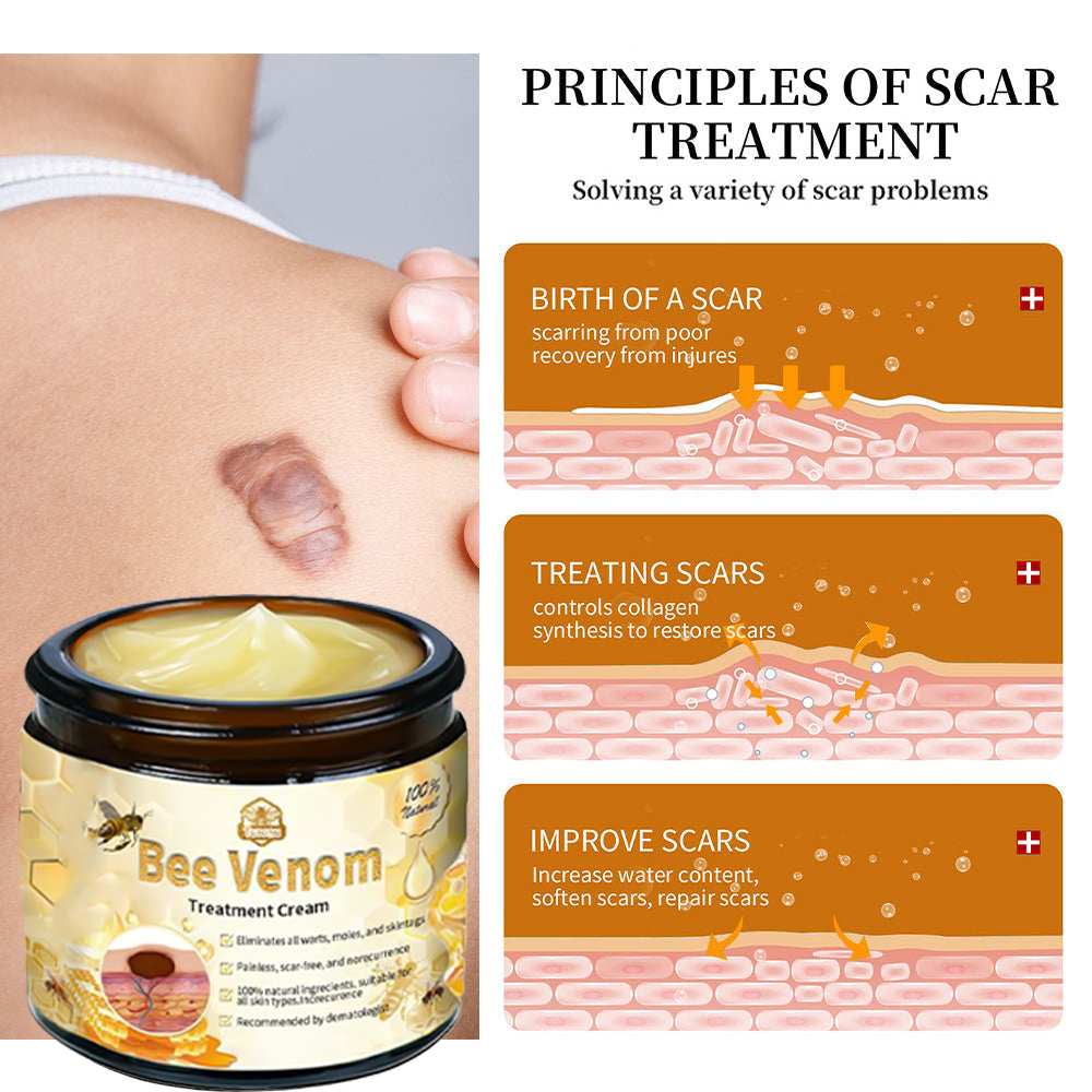 𝗧𝗟𝗢𝗣𝗔® Bee Venom Skin Treatment Cream – AAD Recommended👨‍⚕️(🔥LAST DAY 70% OFF)🔥