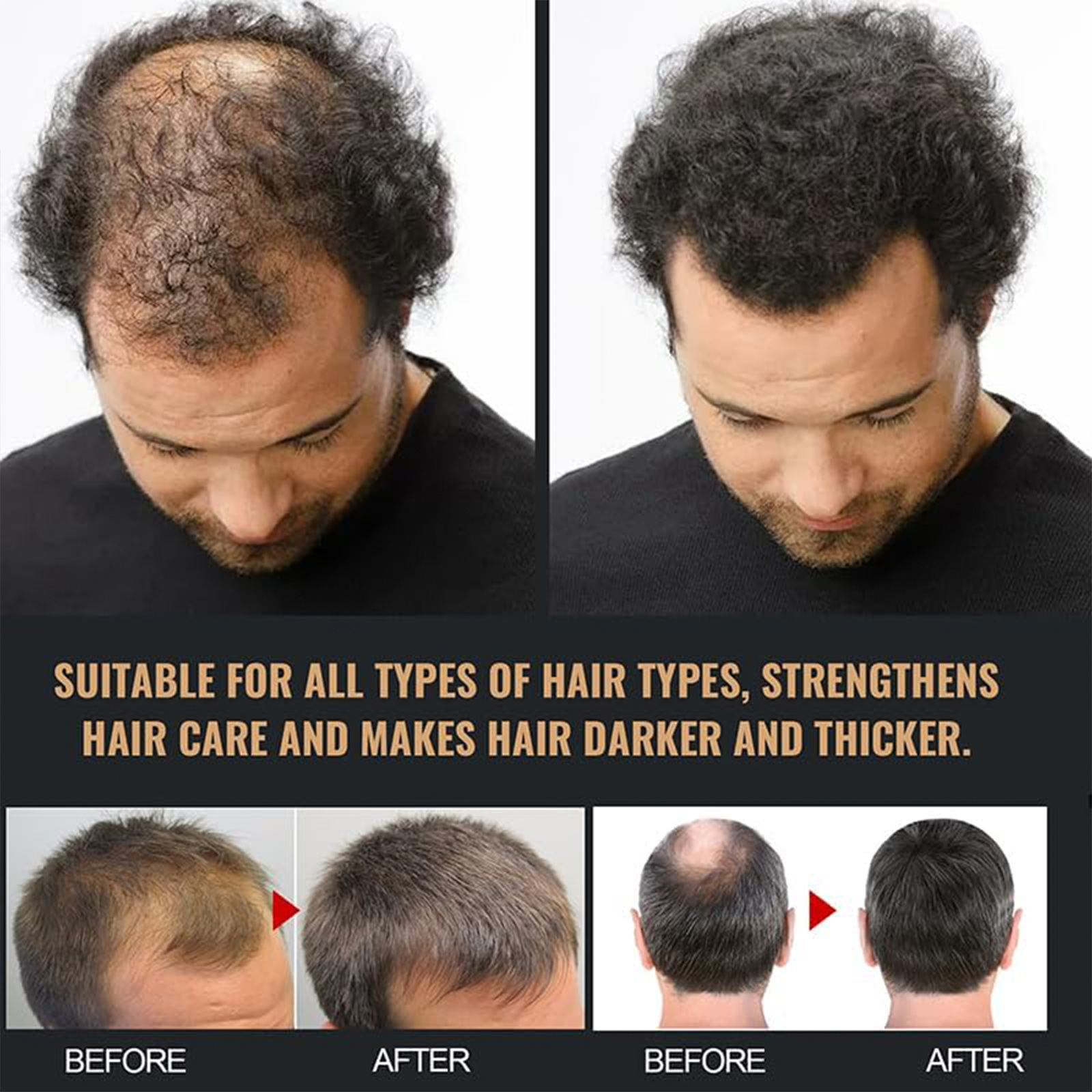 Dobshow Premium Biotin Hair&Beard Booster, 2024 New Upgrade Biotin Hair Serum Spray for Hair And Beard
