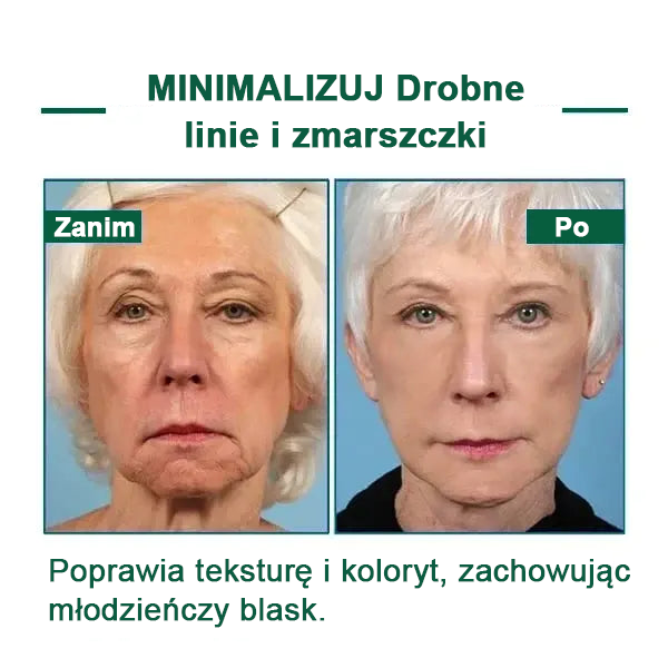 🌿💝Ostatni dzień promocji 60% Zniżki - Fubsta™ Serum odmładzające ujędrniające skórę🔥