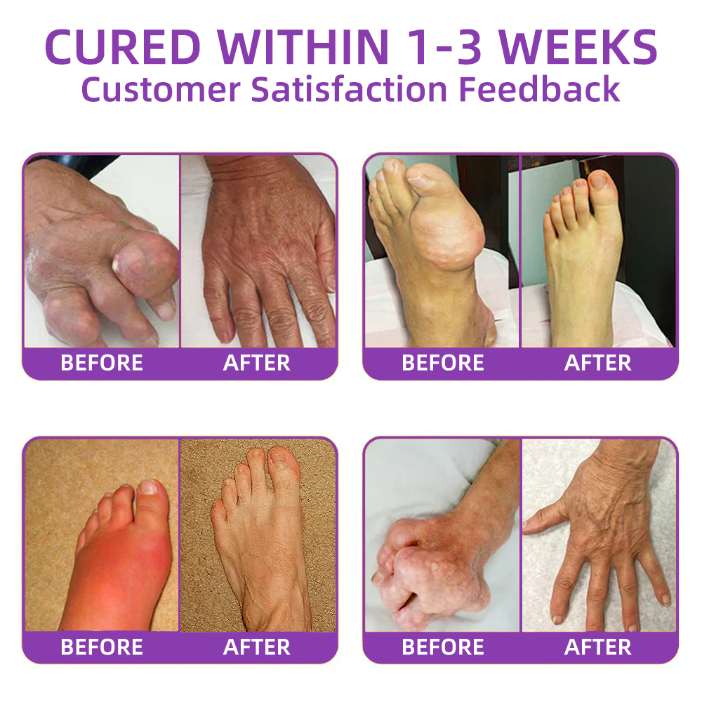 Official Store : TLOPA® Turmeric & Emu Oil Arthritis Soothing Pain Relief Massage Gel 👨‍⚕️ Approved by the American Academy of Orthopaedic Surgeons (AAOS)