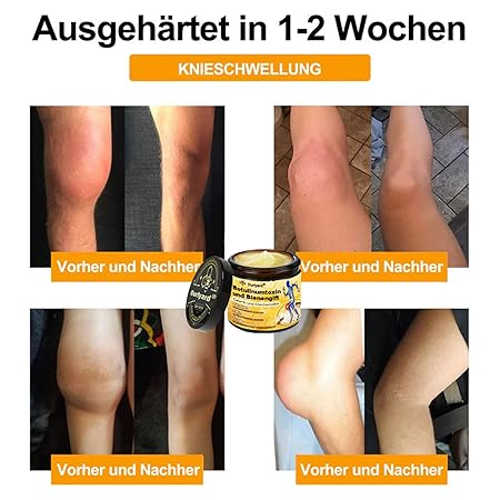 Bienengift-Schmerzlinderungs Knochenheilungs Creme, Professionelle Bienengift Gelenkcreme, Ourlyard Bienengift Gelenkgel, Natürlich Bienengiftsalbe Joint Gel, für Rücken,Nacken,Knie