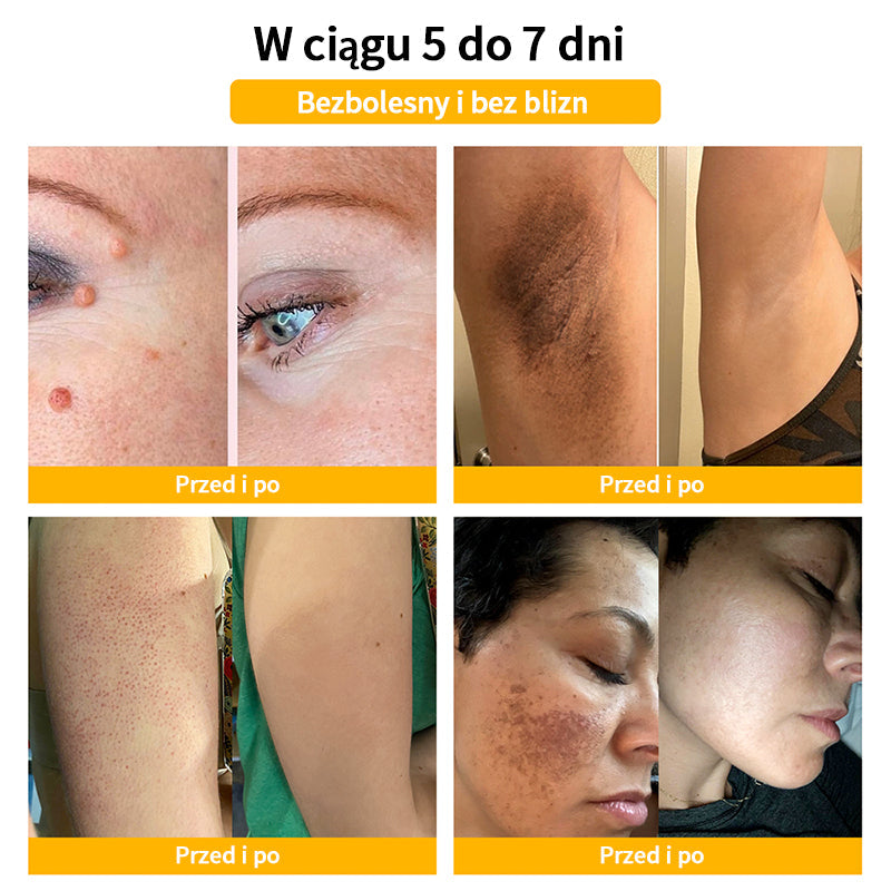 🏪[Oficjalny sklep flagowy] 𝑇𝑢𝑟𝑜𝑛𝑢™ 𝖪𝗋𝖾𝗆 𝖽𝗈 𝗉𝗂𝖾𝗅ę𝗀𝗇𝖺𝖼𝗃𝗂 𝗌𝗄ó𝗋𝗒 𝗓 𝗃𝖺𝖽𝖾𝗆 𝗉𝗌𝗓𝖼𝗓𝖾𝗅𝗂𝗆 (𝗓𝖺𝗅𝖾𝖼𝖺𝗇𝗒 𝗉𝗋𝗓𝖾𝗓 𝖠𝖠𝖣)