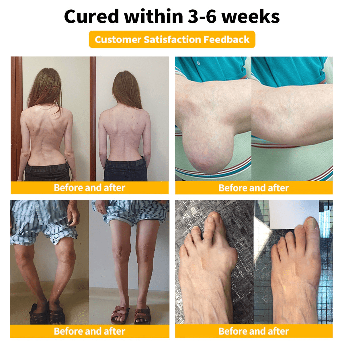 Flysmus™☀️Bee Venom Pain-Relief Bone Healing Cream(Specially for older adults & AOA recommends)