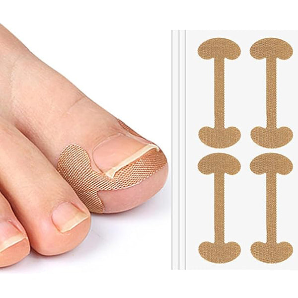 Cithway® Ingrown Toenail Corrector Kit