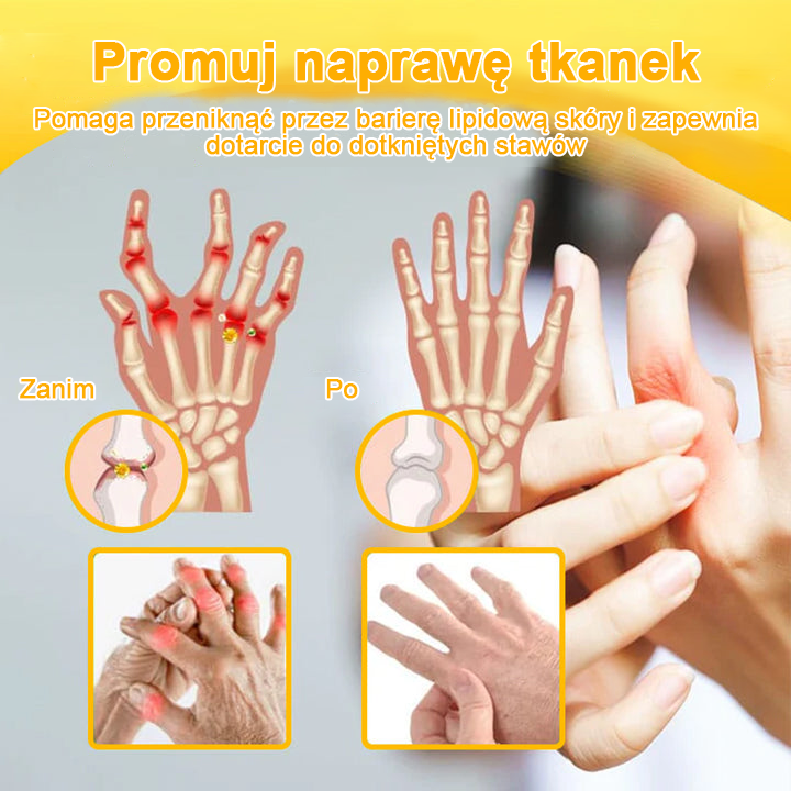 [🏆 Za pobraniem 🏆]💎Lotmay™ krem z jadem pszczelim do zaawansowanej terapii stawów i kości (ekstrakt z pszczoły nowozelandzkiej, specjalistyczny na schorzenia ortopedyczne i bóle stawów)💎