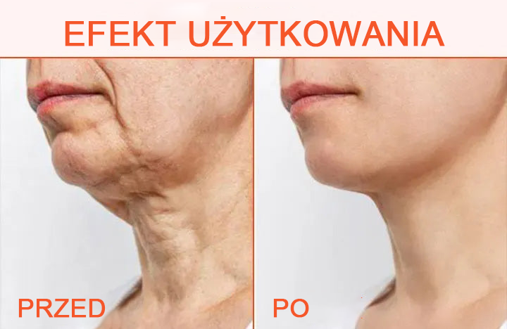 🌠 70% Rabaty ✨𝗖𝗼𝗼𝗹𝗼𝗿𝗱® - 𝐋𝐮𝐱𝐞𝐋𝐢𝐟𝐭 Ujędrniający i tonizujący krem do ciała✨