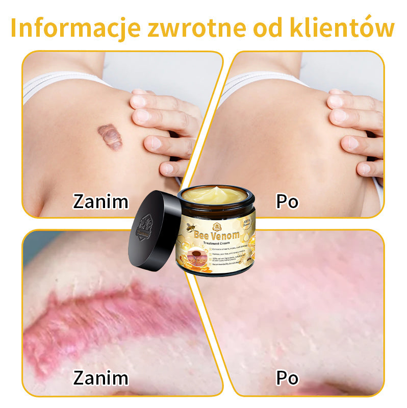 🐝🏪[Oficjalny sklep flagowy] 𝑇𝑢𝑟𝑜𝑛𝑢™ 𝖪𝗋𝖾𝗆 𝖽𝗈 𝗉𝗂𝖾𝗅ę𝗀𝗇𝖺𝖼𝗃𝗂 𝗌𝗄ó𝗋𝗒 𝗓 𝗃𝖺𝖽𝖾𝗆 𝗉𝗌𝗓𝖼𝗓𝖾𝗅𝗂𝗆 (𝗓𝖺𝗅𝖾𝖼𝖺𝗇𝗒 𝗉𝗋𝗓𝖾𝗓 𝖠𝖠𝖣)