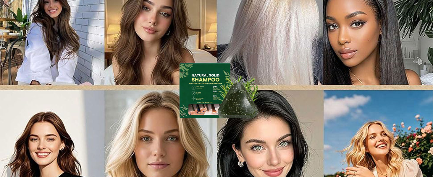 Yoracare Korean Scalp Revival Bar, 2026 Yoracare Rosmarin & Aminosäuren stärkender Anti-Verdünnungs-Shampoo-Riegel, feuchtigkeitsspendende und kopfhautfreundliche Kräuterpflege 80g
