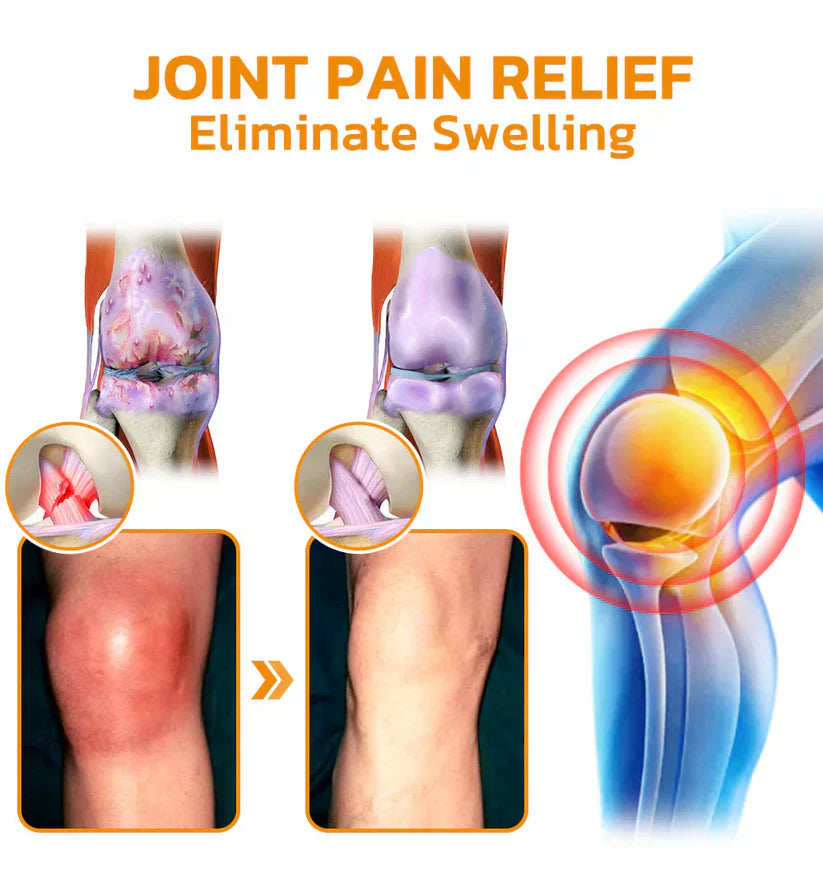 Official Store: TLOPA® Bee-Venom Pain-Relief Bone Healing Cream👨‍⚕️USA Osteopathic Medical Association (AAOS) Approved(Reducing joint swelling, pain, stiffness, redness, warmth, soreness, and joint fatigue)